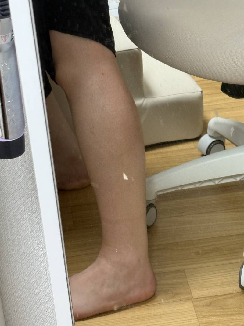 [잡담] 나는 몸무게에 비해? 종아리는 덜나가는스타일? 이라 그나마 다행이라생각함.. | 인스티즈