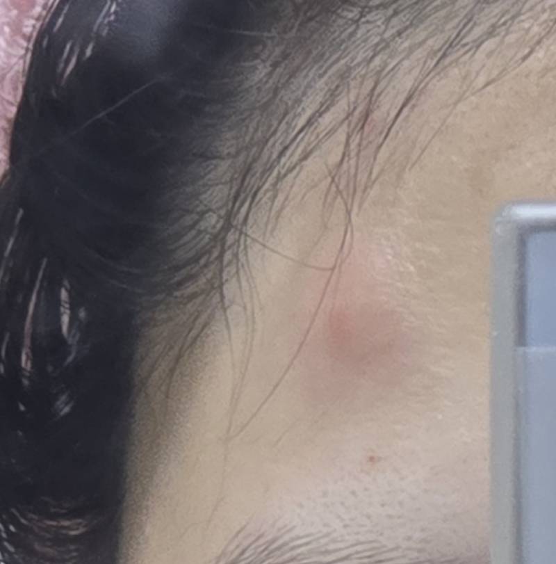 [잡담] 야... 이정도면 혹 아니니? 얻어맞았어 지금 | 인스티즈