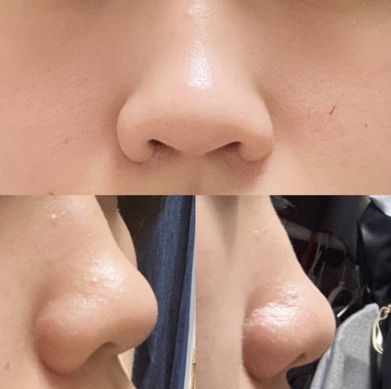 [잡담] 안장코에 매부리인가 ....? | 인스티즈