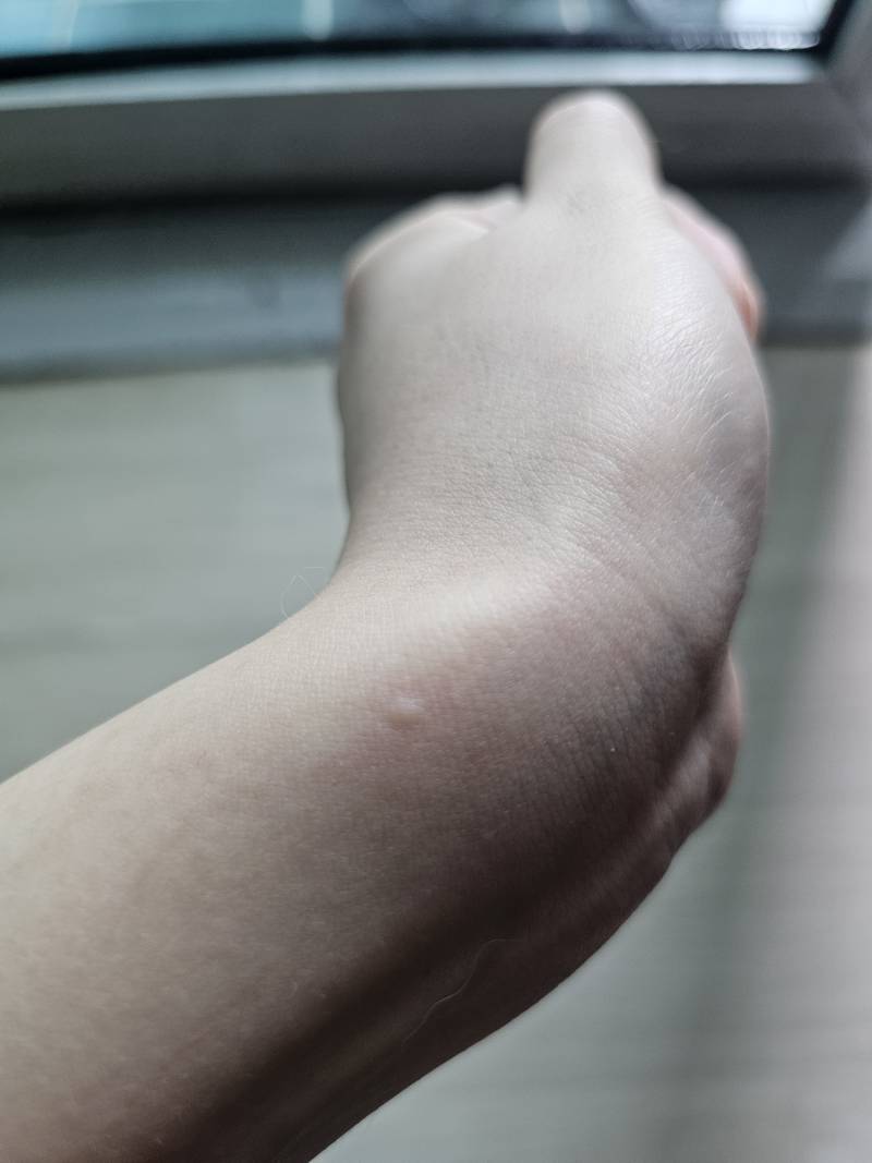 [잡담] 이런건 보통 뭐에 물린거야?? | 인스티즈