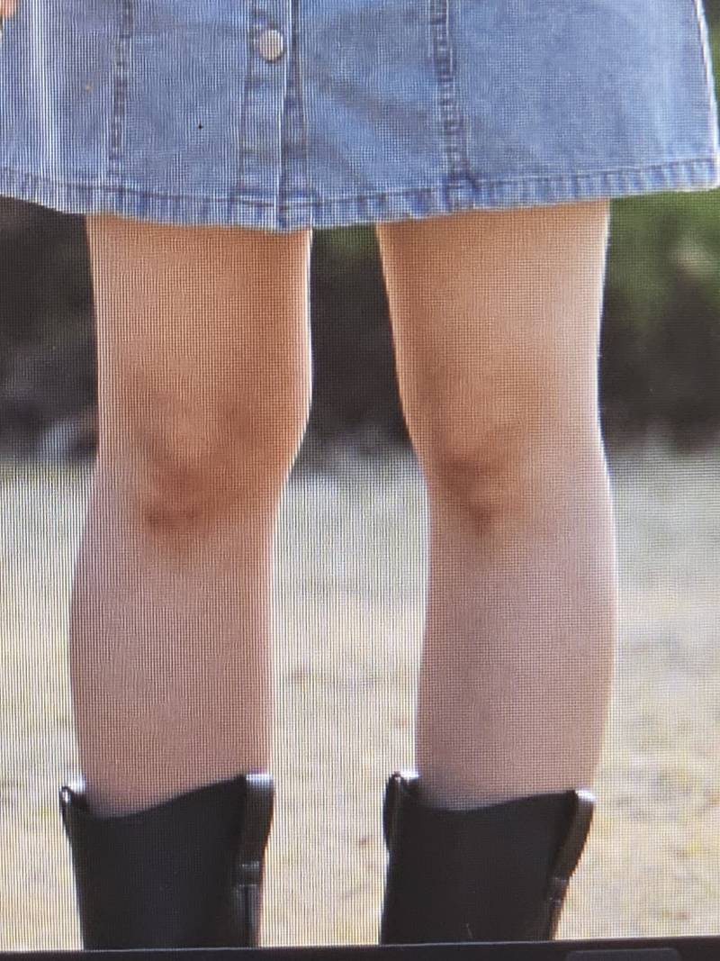 [잡담] 나 종아리랑 허벅지 두께 같다 | 인스티즈