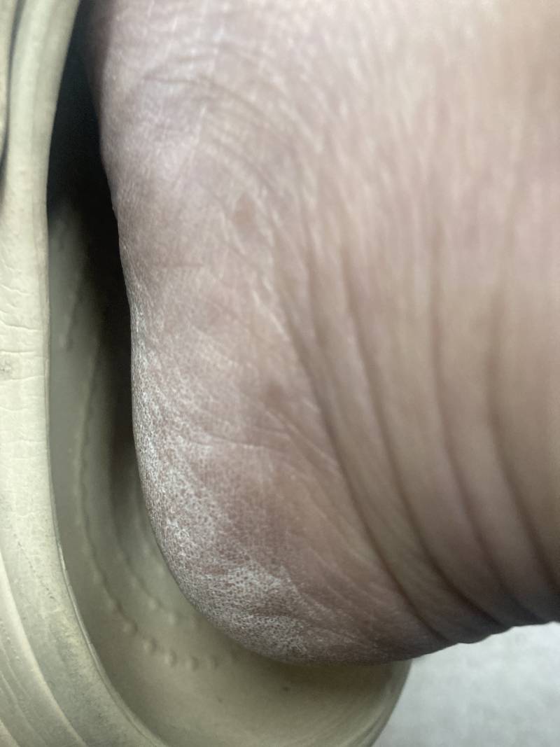 [잡담] 내 발 드러운거야? | 인스티즈