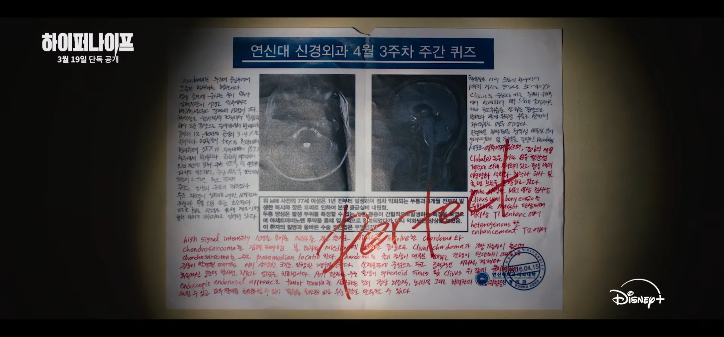 [잡담] 하이퍼나이프 박은빈 글씨체 바뀐 거 볼래? | 인스티즈