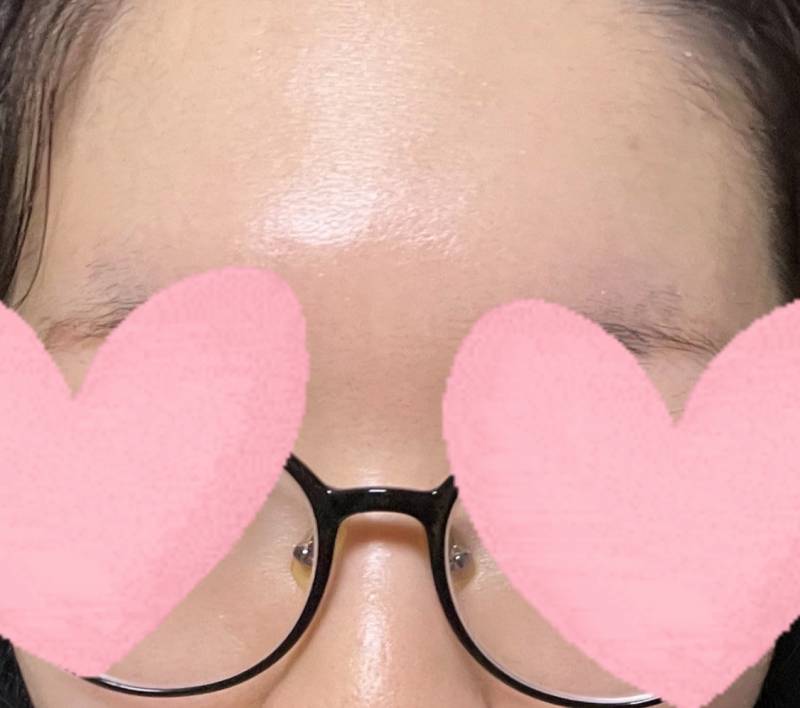 [잡담] 나 정도면 피부 좋은 거 아니야?? | 인스티즈