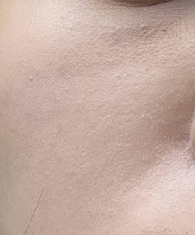 [잡담] 피부결 안좋은건 뭐가 문제야?? | 인스티즈