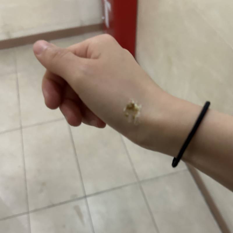 [잡담] 길가다 새똥맞을 확률이 몇퍼나댐??? | 인스티즈