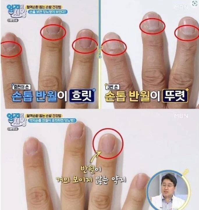 한의사 피셜 당뇨 진단법. jpg | 인스티즈