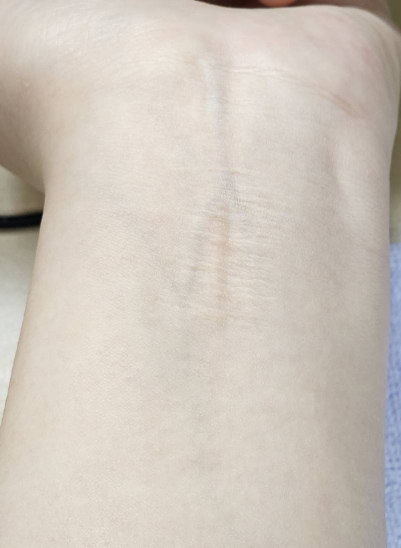 [잡담] 간호익들아 이거 그냥 주름 같지? | 인스티즈
