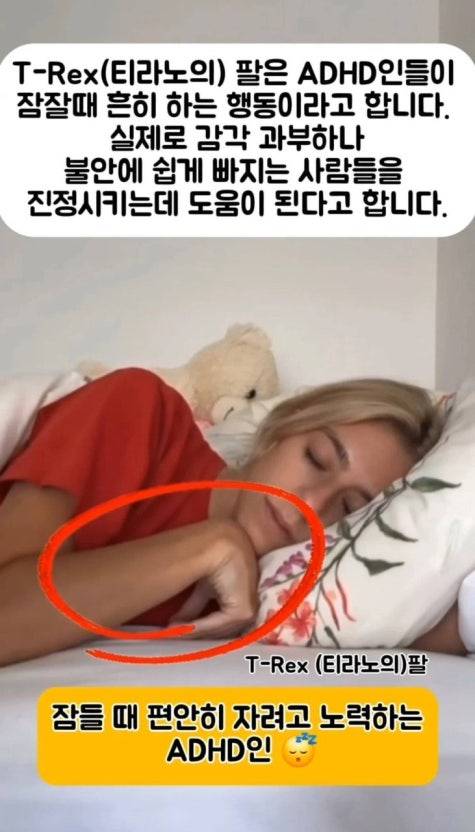 [잡담] ADHD 있는 사람들이 잘 때 티라노 자세로 잔다던데 | 인스티즈