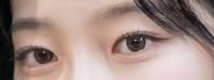 [잡담] 쌍수할건데 이 라인 들고가면 후회할까? | 인스티즈