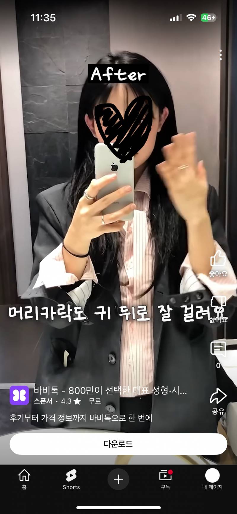 [잡담] 외모 정병 레전드찍은 한국... 귀 필러(?) 생김 | 인스티즈