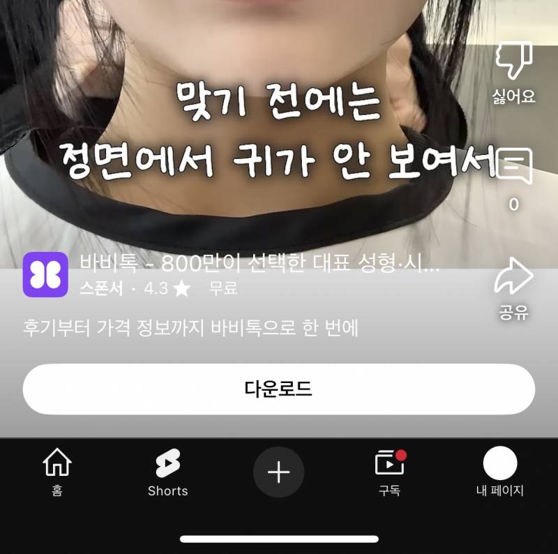 [잡담] 외모 정병 레전드찍은 한국... 귀 필러(?) 생김 | 인스티즈