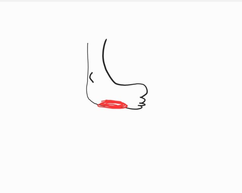 [잡담] 발 바깥쪽 아파본 적 있는 사람?? | 인스티즈
