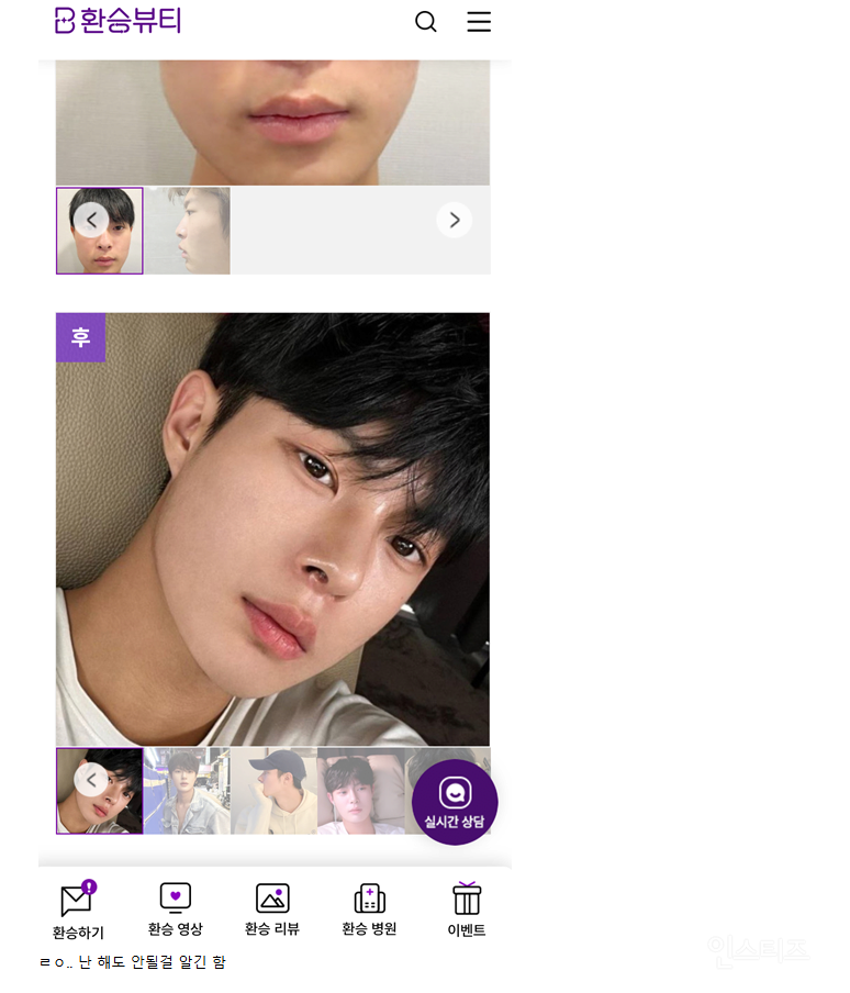 남자 성형 레전드 후기 | 인스티즈