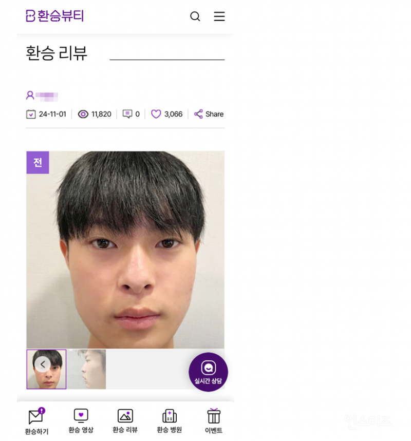남자 성형 레전드 후기 | 인스티즈