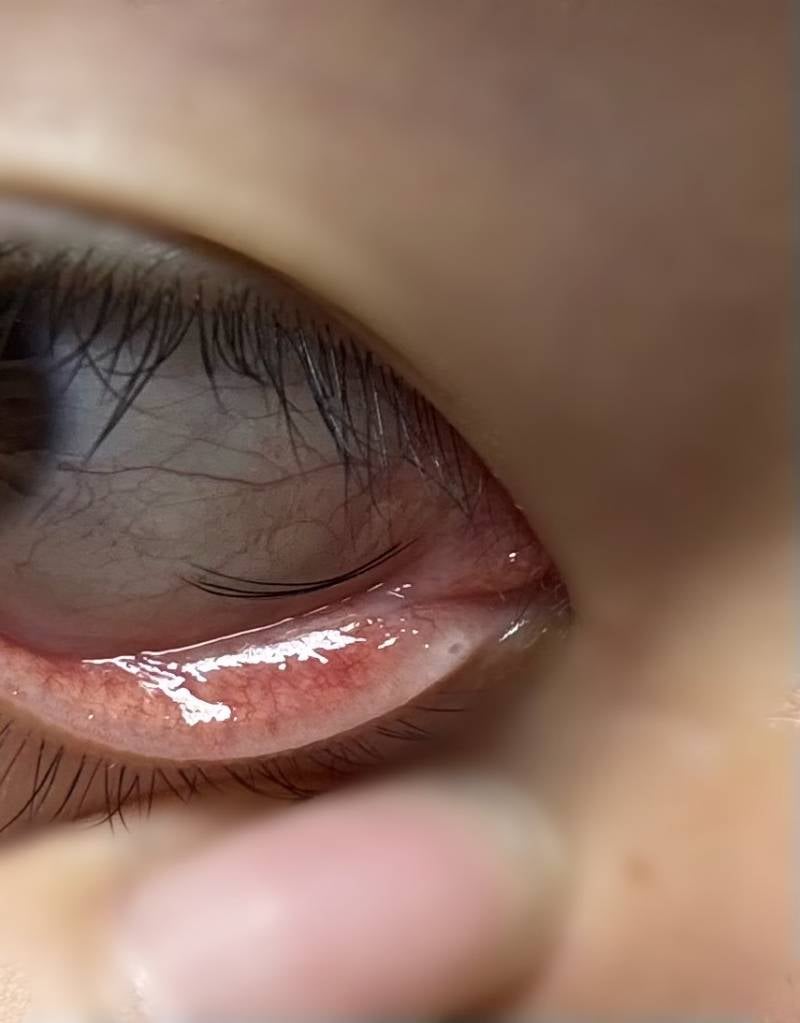 [잡담] 눈안에 속눈썹 역대급 많이들어감.. | 인스티즈
