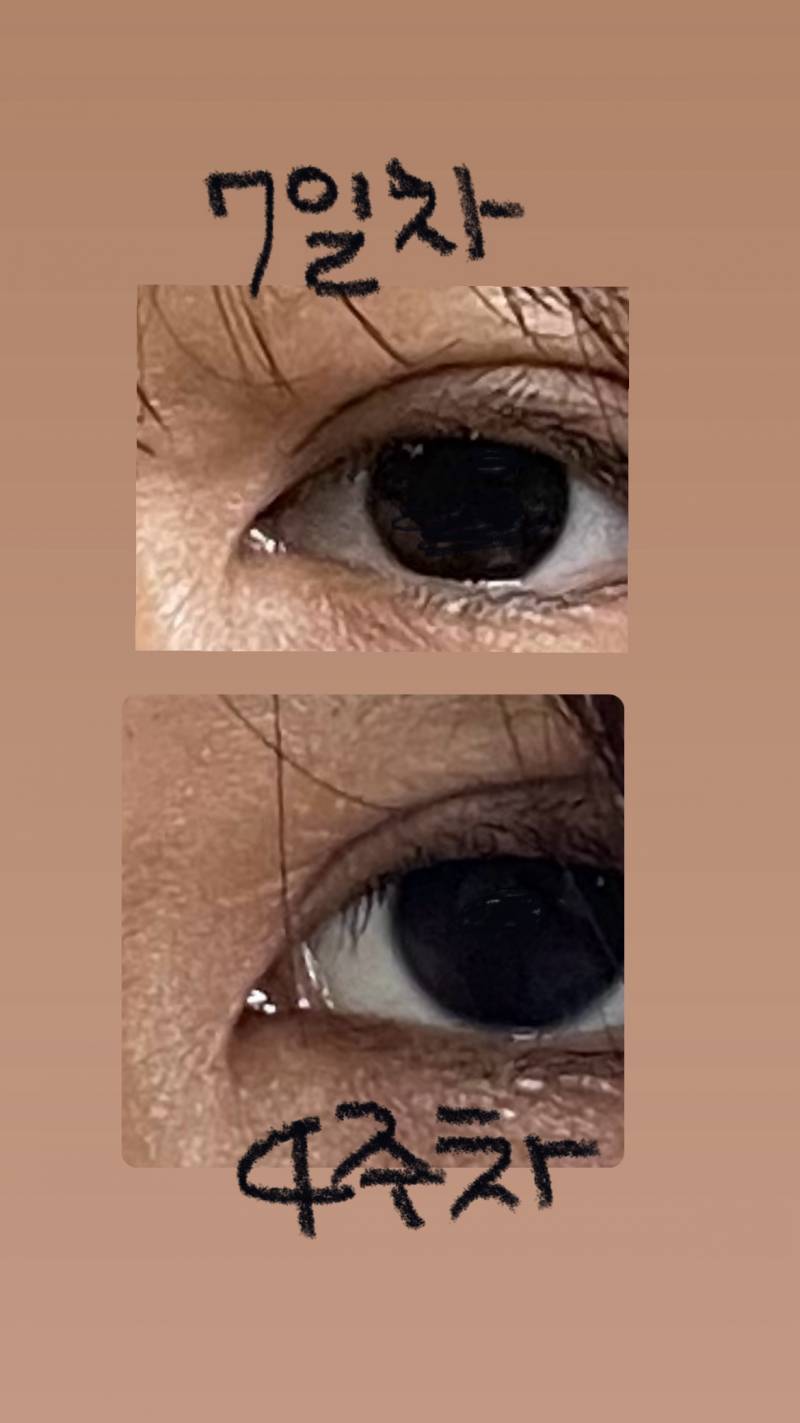[잡담] 윗트임 오므라든거같은데 | 인스티즈