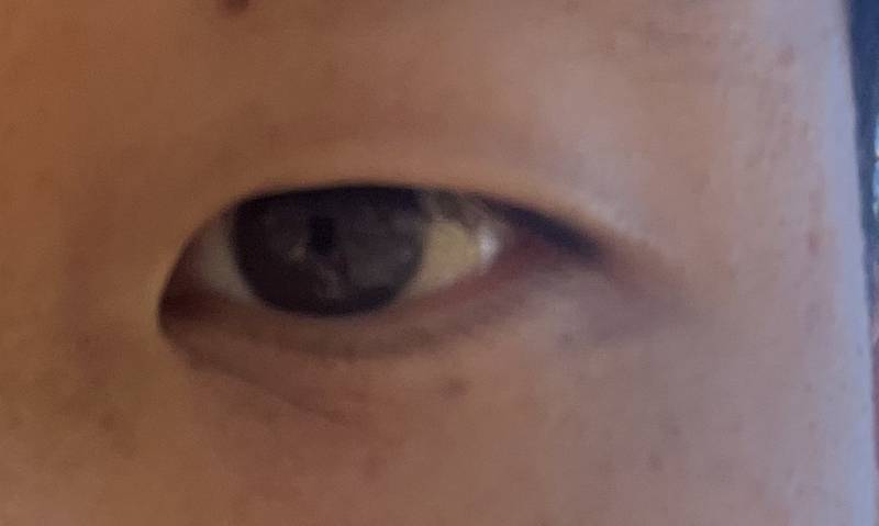[잡담] 이거 앞트임하면 ㄱㅊ을까? | 인스티즈