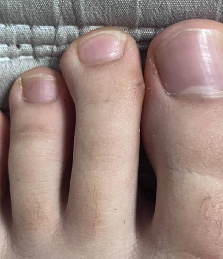 [잡담] 발가락 평가해주라 | 인스티즈