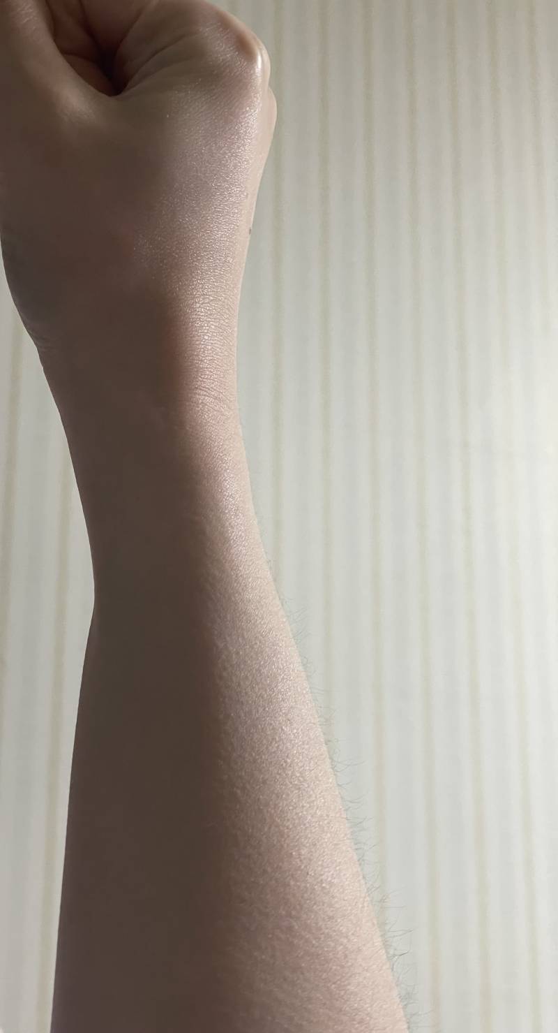 [잡담] 나 팔 왜이러는지 아는 사람 | 인스티즈