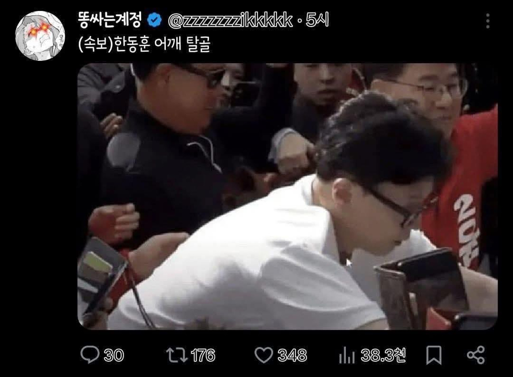 [잡담] 한동훈 어깨 탈골됨 | 인스티즈
