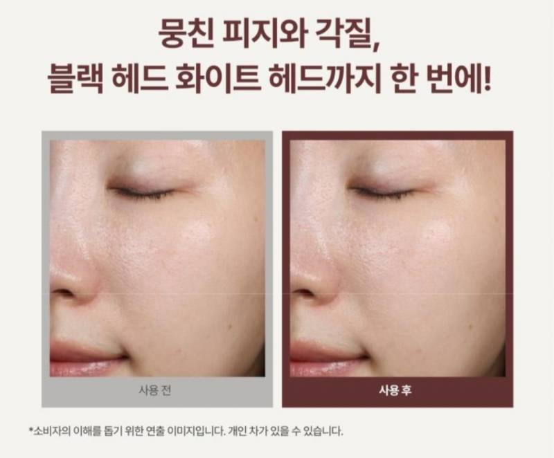 [잡담] 이거 나만 사용전이 피부 더 좋아보여? | 인스티즈