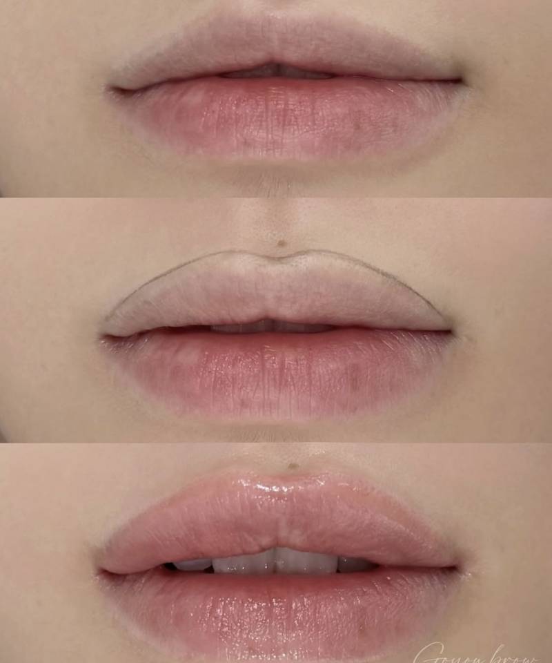 [잡담] 입술 필러랑 반영구 타투중에 뭐가나을까 ㅠㅠㅠㅠ | 인스티즈