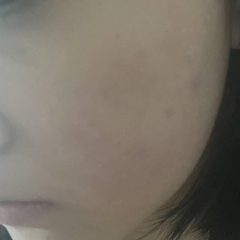 [잡담] 나 볼살 몸무게에 비해서 많은편이야..? | 인스티즈