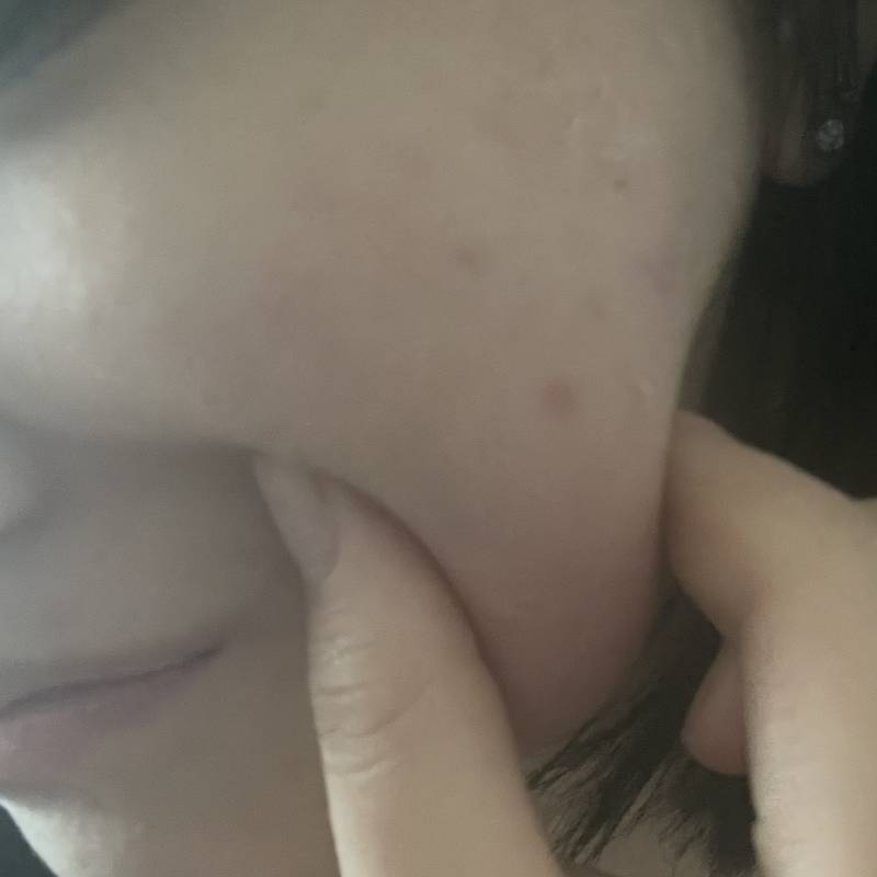 [잡담] 나 볼살 몸무게에 비해서 많은편이야..? | 인스티즈