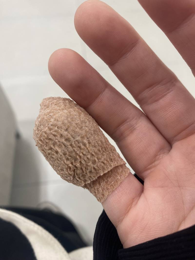 [잡담] 익들아 나 손가락 개큰일났는데 오늘 알바갈 수 있을까 ㅠㅠㅠㅠ | 인스티즈