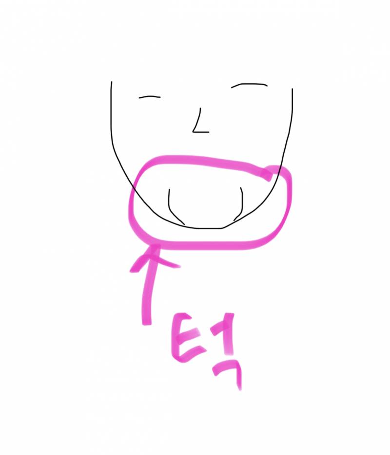 [잡담] 나같은 턱? 이런건 어떤 시술 받아야해? | 인스티즈