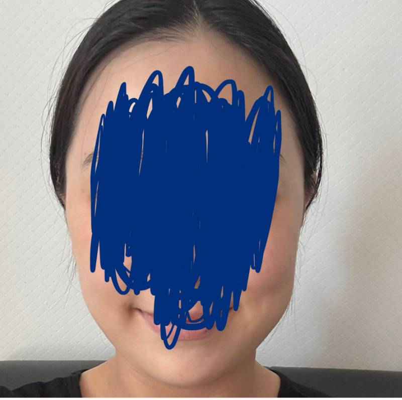 [잡담] 나 살빼면 얼굴형 좀 나아질까? | 인스티즈