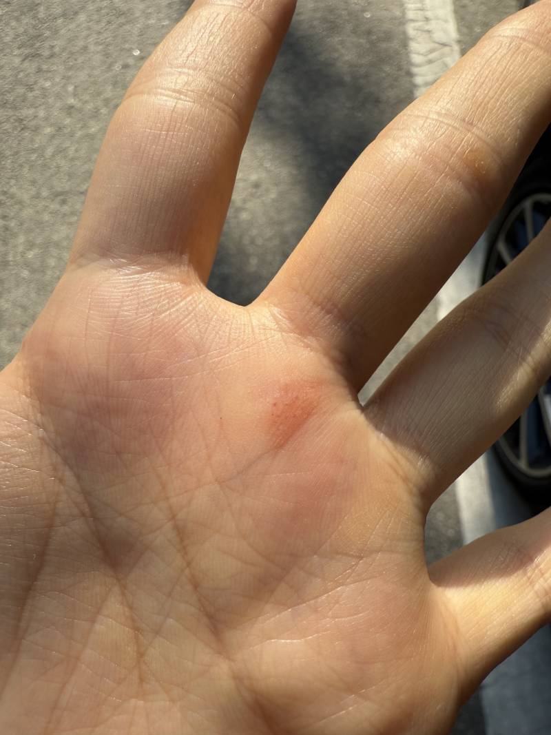 [잡담] 나 자꾸 이런거 물리는데 뭐야????? | 인스티즈