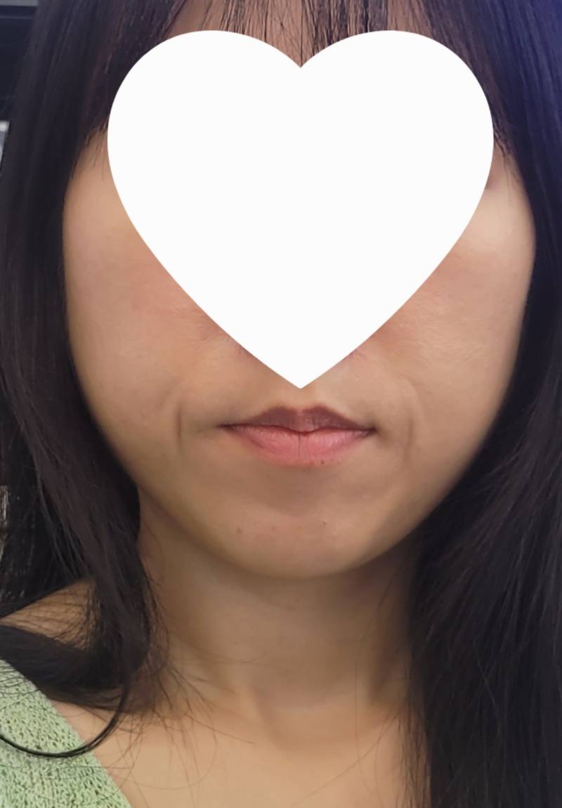 [잡담] 교정 전 후.... | 인스티즈