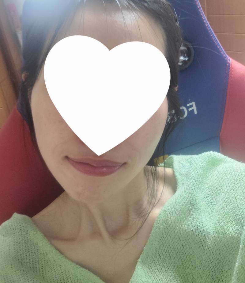 [잡담] 교정 전 후.... | 인스티즈