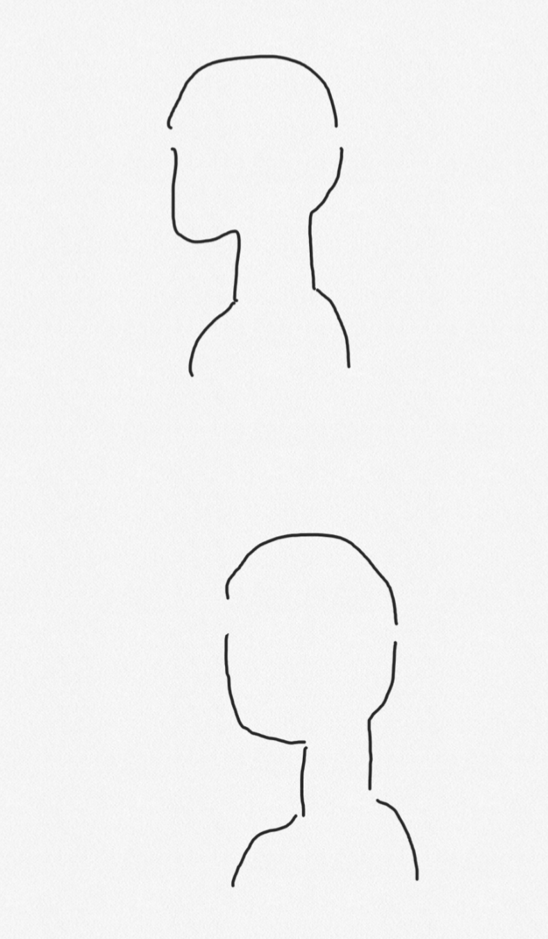 [잡담] 레이저리프팅 시술 안 받고도 턱선이 위 그림처럼 착 올라붙고 뾰족할 수 있어? | 인스티즈