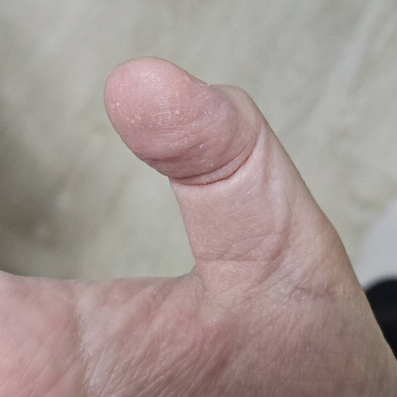 [잡담] 애들아 나 손 끝이 이런데 뭐해야해ㅜㅜ | 인스티즈