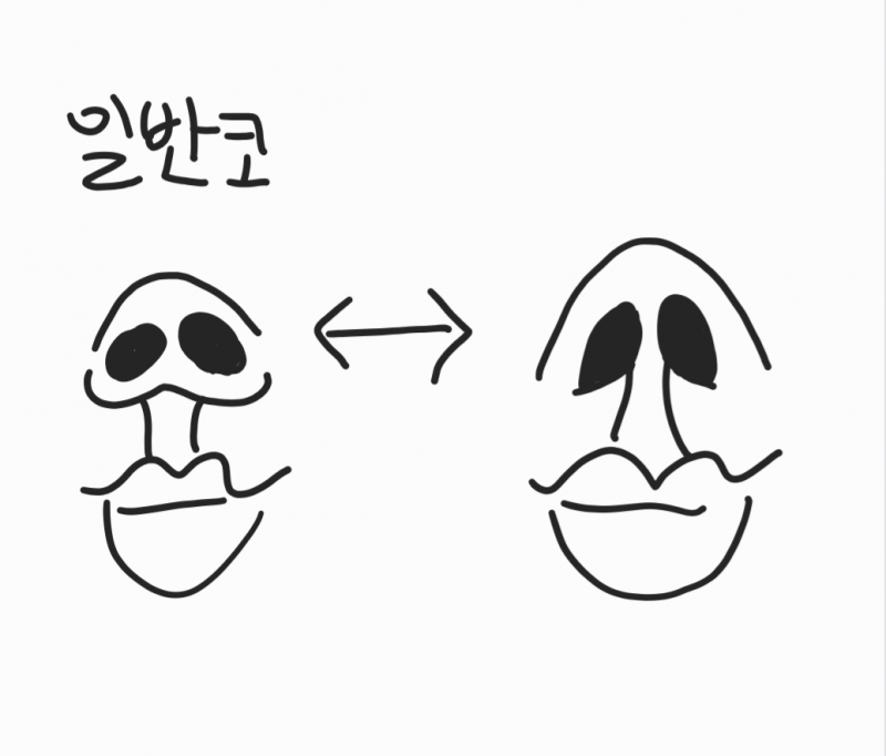 [잡담] 인중축소수술 과하면 엄청 부자연스러운것 같음.. | 인스티즈