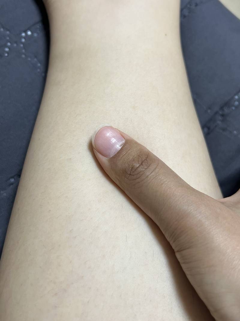 [잡담] 종아리랑 손가락 피부색 차이 | 인스티즈