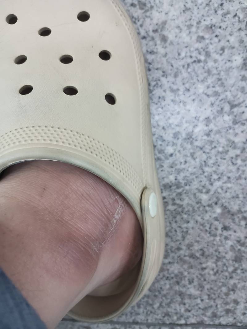 [잡담] 내 발 평가좀 | 인스티즈