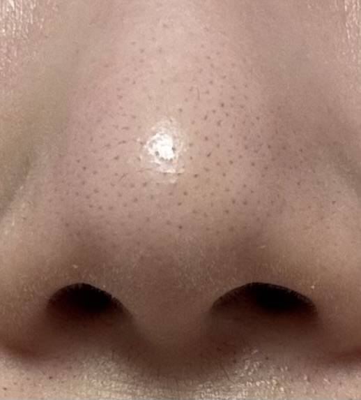 [잡담] 나 코블랙헤드 레젇드다 ㄷㄷ,, (혐오주의) | 인스티즈