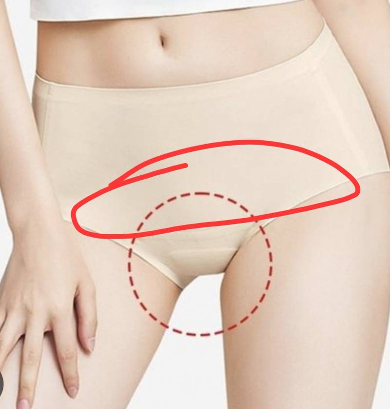 [잡담] 다들 소중이 근처에 뾰루지 나?? | 인스티즈