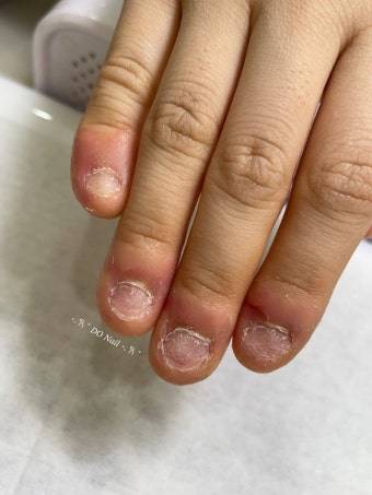 [잡담] 얼굴 ㄱㅊ은데 단풍손이면 어때..? | 인스티즈