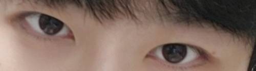 [잡담] 쌍수 전vs후 | 인스티즈