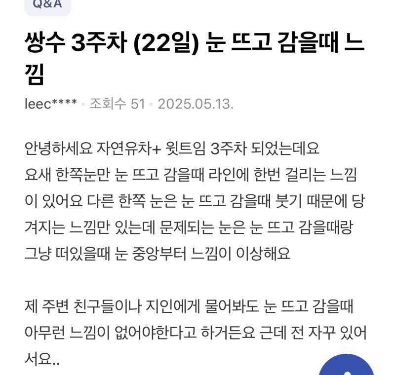 [잡담] 쌍수 자연유착 눈매교정 눈 감을때 느낌 | 인스티즈