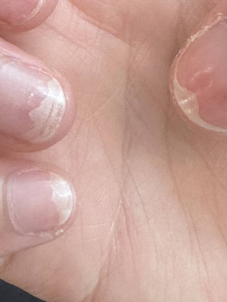 [잡담] 네일샵 잘못고르고 손톱 이래됐어ㅠㅠ | 인스티즈