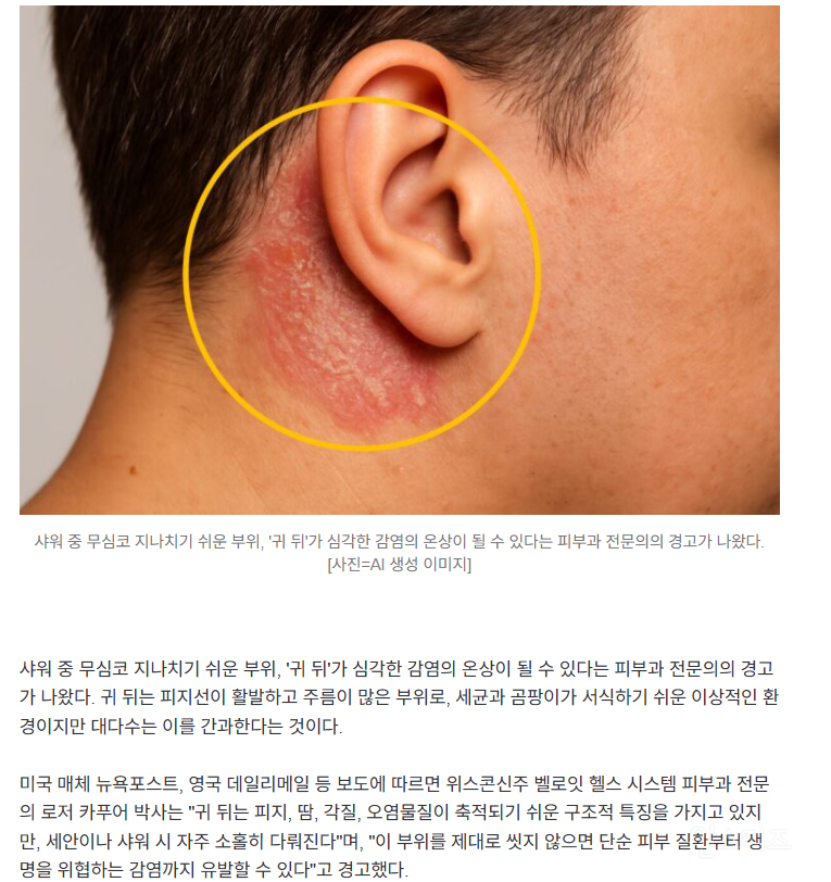 귀 뒤를 깨끗하게 씻어야 하는 이유.jpg | 인스티즈