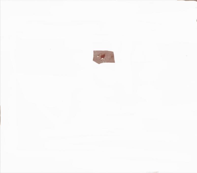 [잡담] ㅎㅇㅈㅇ 코 옆 나비존? 볼?에 있던 블랙헤드 빠졌다 | 인스티즈