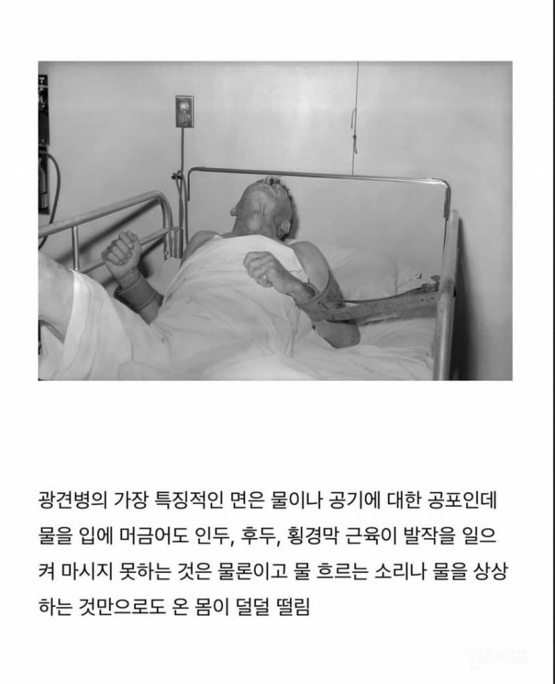 치사율 99% 이상이라는 발병후 죽는다고 보면 된다는 무서운 바이러스 .jpg | 인스티즈