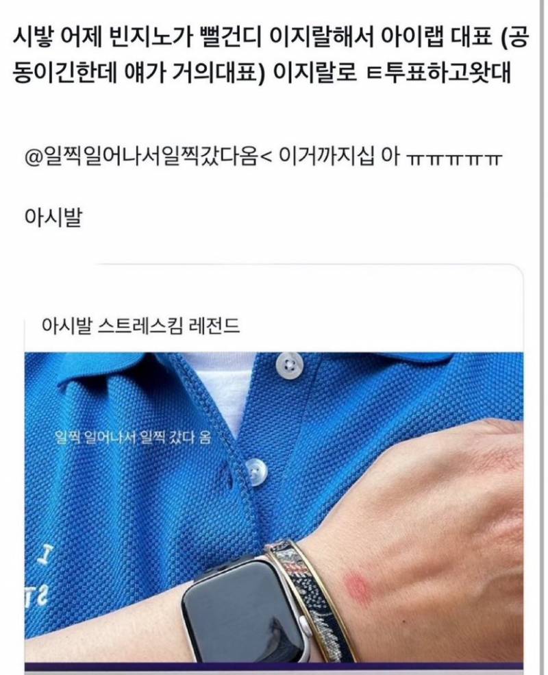 빈지노가 뻘건디 이 𝙕𝙄𝙍𝘼𝙇 해서 | 인스티즈